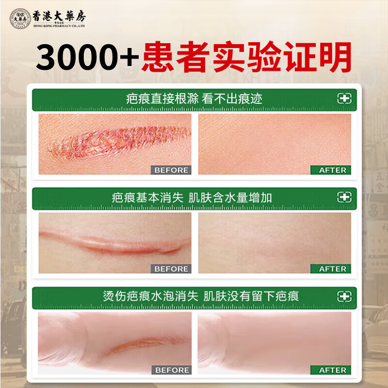 香港大药房疤痕膏旧疤伤疤淡印凹凸增生痘坑软膏痘印痘坑 1瓶 买2送1