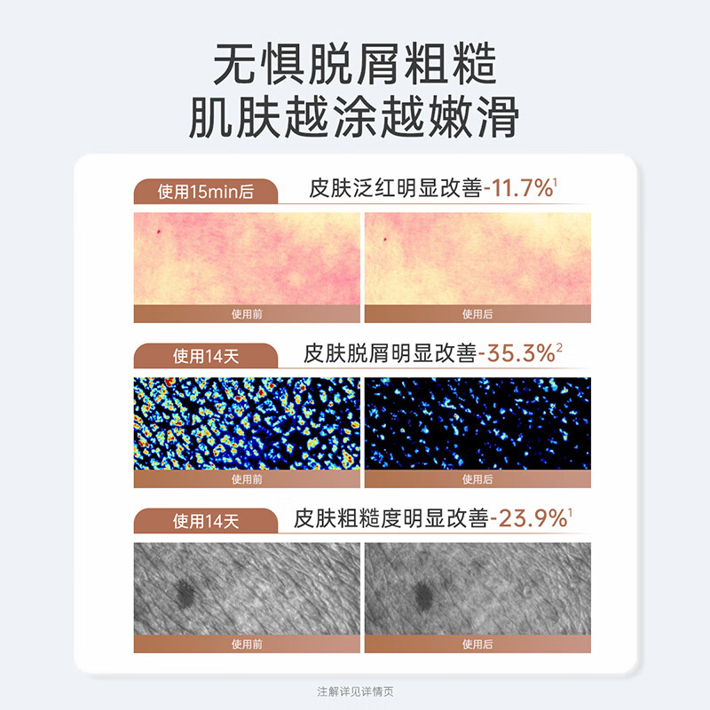袋鼠妈妈【全新升级】准孕妇可用保湿滋润身体乳嫩肤润肤乳护手霜护肤品 【囤货组合】小麦身体乳300g*2