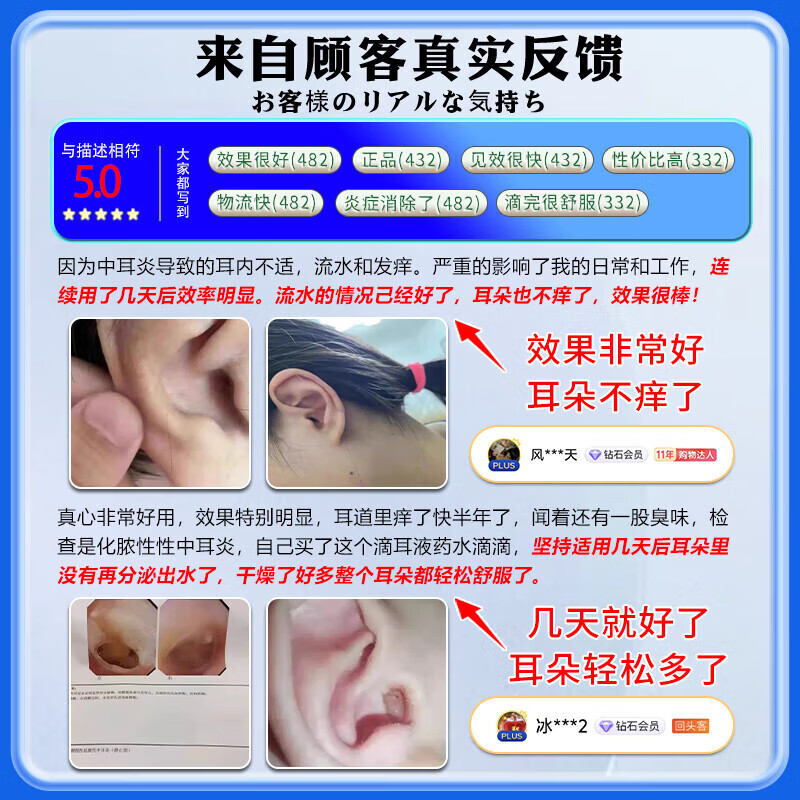 岩井昃弘制药日本进口中耳炎滴耳液专用的药治疗耳道发炎流脓水止痒抑菌儿童用 1盒装【进口特效】