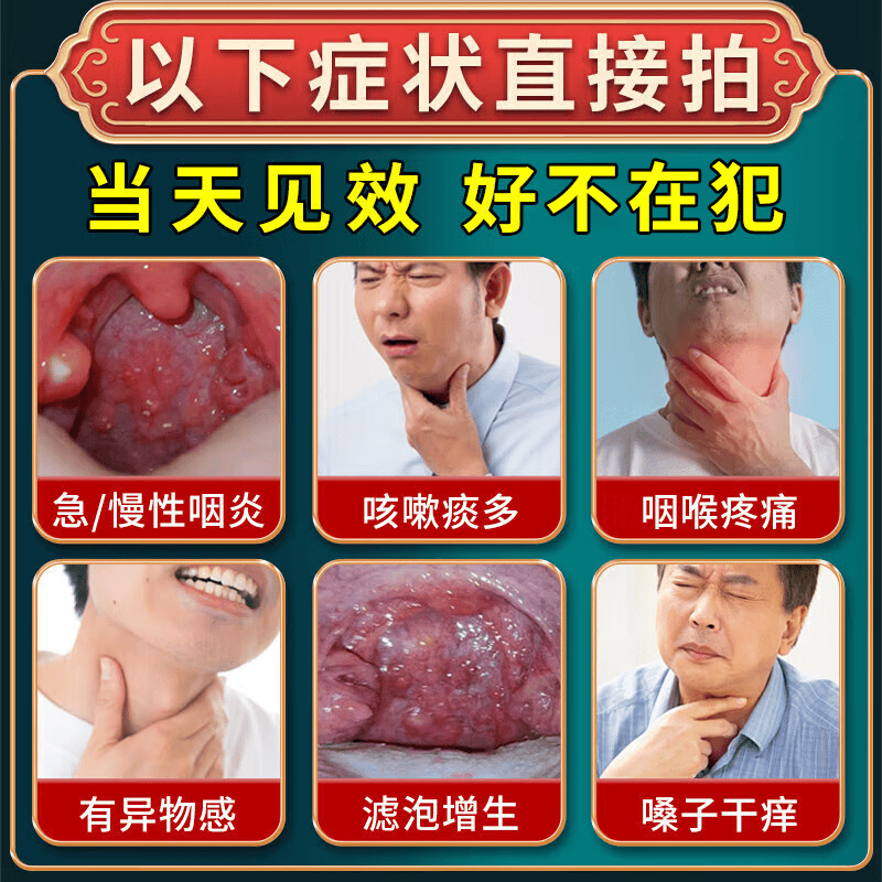 岩井昃弘进口咽喉炎专用膏药贴重度急慢性咽炎喉咙痒干咳呕痒异物感咽扁 特效一盒【日本原装】多买多送 咽喉炎的喉咙痒异物感有粘痰