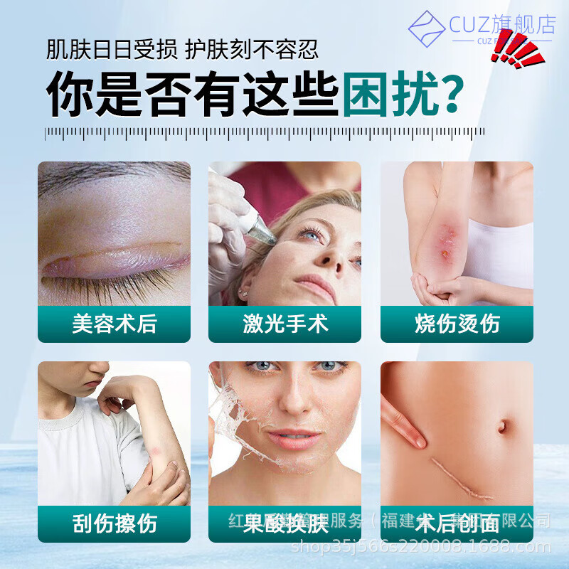 熏姿颜hue硅酮敷料祛i疤膏除i疤痕增生凸起去除疙瘩修复手术剖腹产医用 一盒【体验装】 官方直售