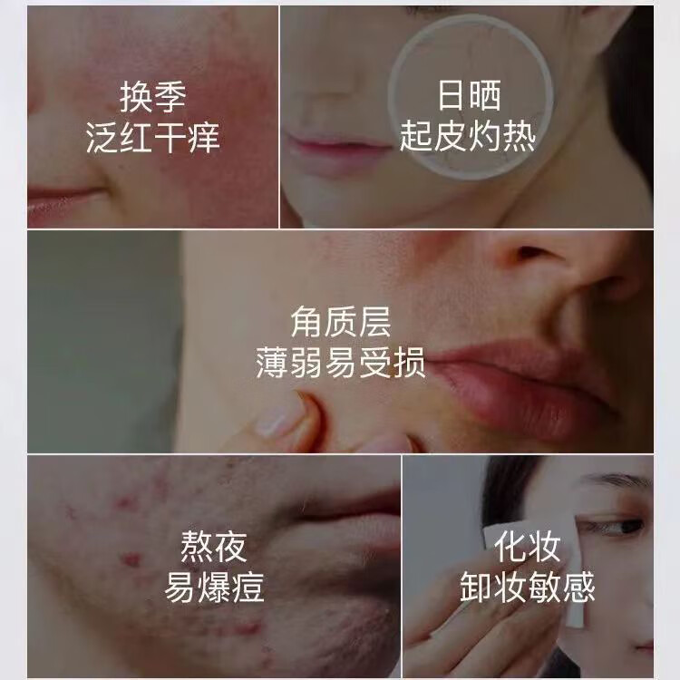 修正修护面霜角质层薄敏痘肌干痒泛红血丝换季干燥多维屏障修护霜50克 3瓶【多维屏障修护霜】 50克/瓶