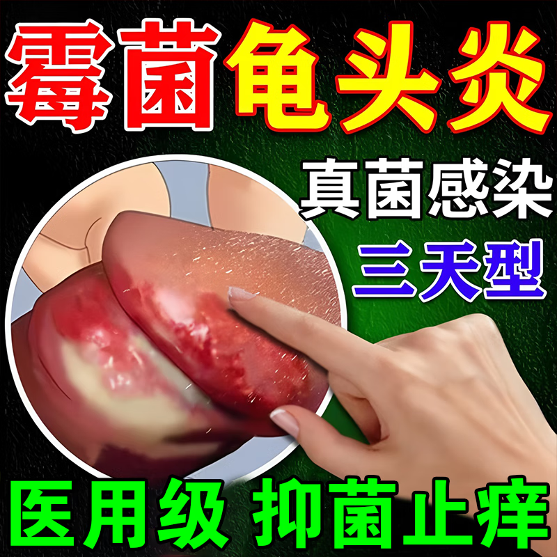 [恒久远]克霉唑乳膏 10g 1盒装 克霉唑乳膏男性龟头炎白垢豆腐渣专用膏药正品男士龟头炎真菌感染红肿专用特新效期药 龟头炎专用膏药龟头真菌感染京东