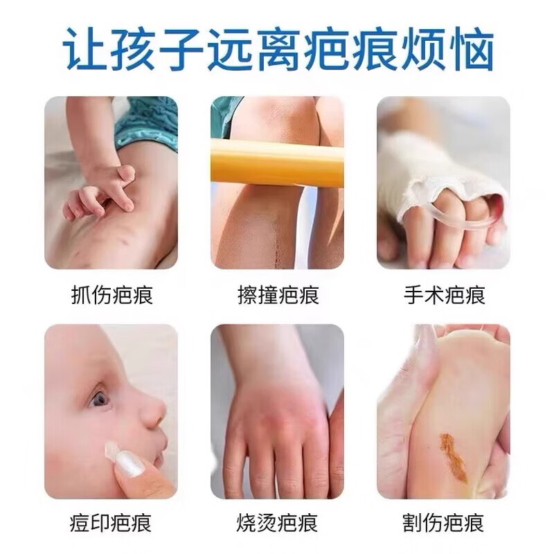葵花指甲抓伤疤痕修复除疤膏药膏儿童脸部指甲抓伤疤痕修复除疤膏医用 单盒【体验装】