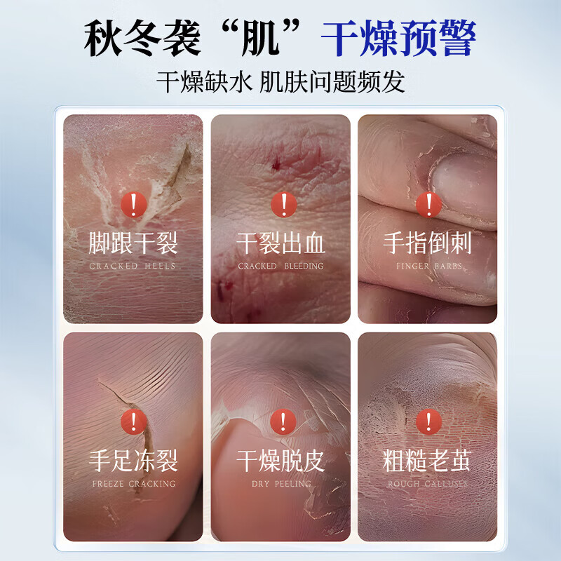 Sunoyar凡士林手足干裂脚裂膏脚后跟干裂开裂皲裂膏防冻疮防裂膏 5盒装【买3送2】拒绝粗糙防止干裂