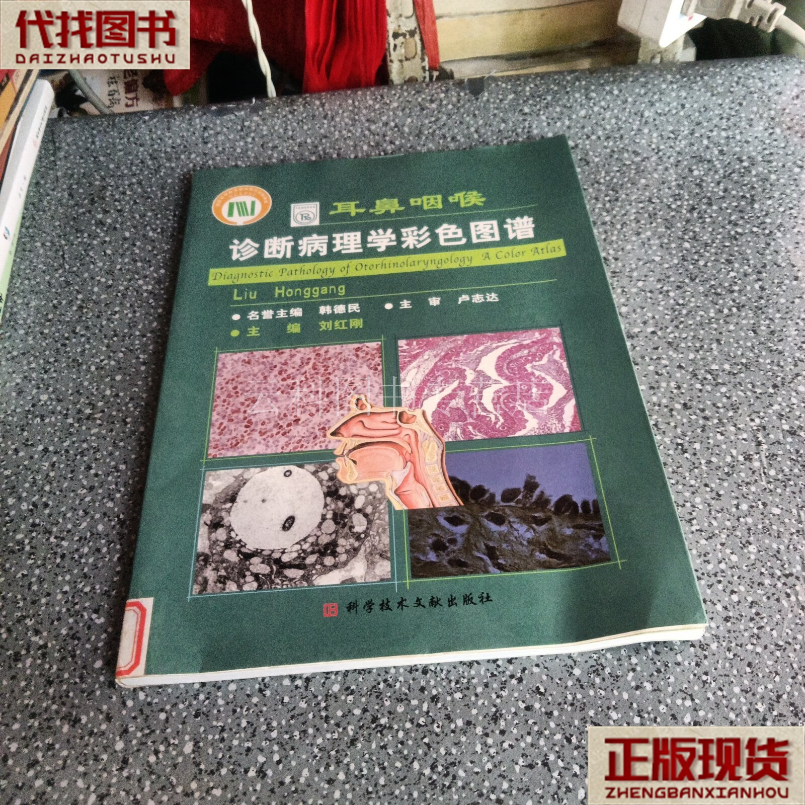 耳鼻咽喉诊断病理学彩色图谱 刘红刚 主编 科技文献出版社 二手书