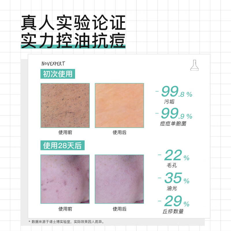 NOVEXPERT法国进口 诺士博青少年洗面奶 男女孩青春期专用 控油祛痘洁面乳 祛痘洗面奶150g+祛痘面霜30g