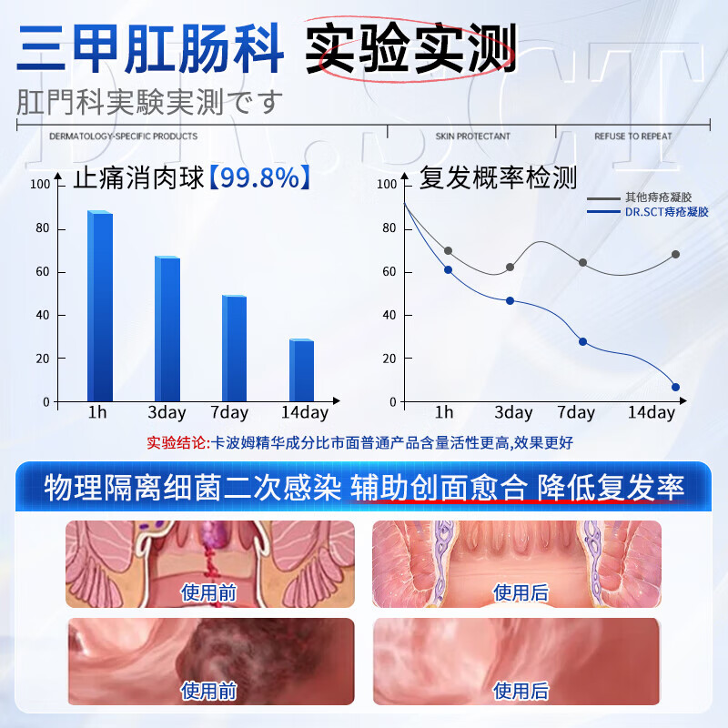 DR.SCT痔疮膏去肉球凝胶神器去内外混合痔肛门瘙痒便秘便血通用 升级款痔疮凝胶【5盒装】