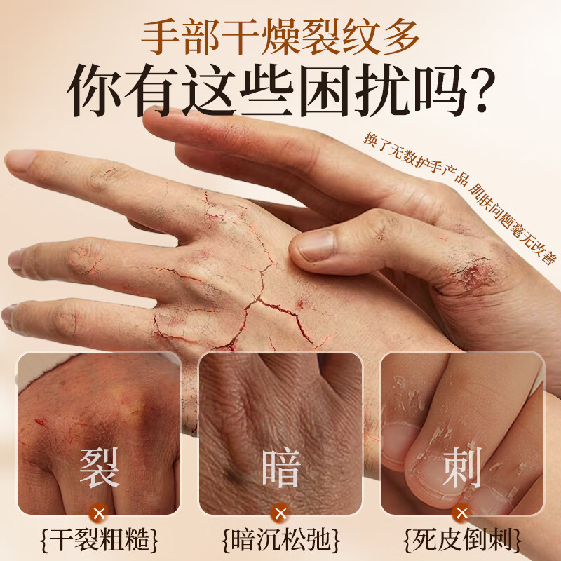 劳丽诗香氛精华护手霜凡士林矿脂补水保湿改善干裂粗糙滋润瘙痒秋冬季 【4款香随机】浪漫香氛精华护手霜*3支