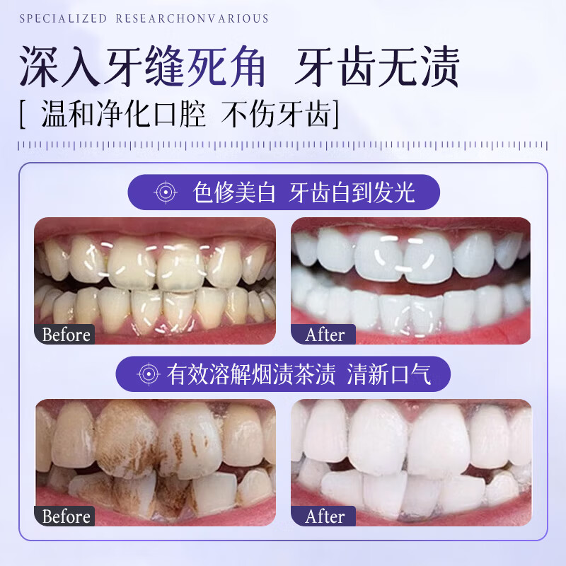 Croent葡萄籽牙膏清新口气减轻牙渍牙垢牙黄口腔牙龈护理牙齿洁白 葡萄籽牙膏3支