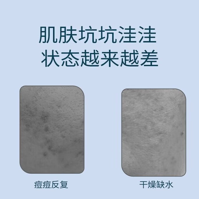 自然旋律冻干粉套盒寡肽原液精华液面部祛痘保湿男女护肤品旗舰店官方正品 【买7发9】冻干粉9盒