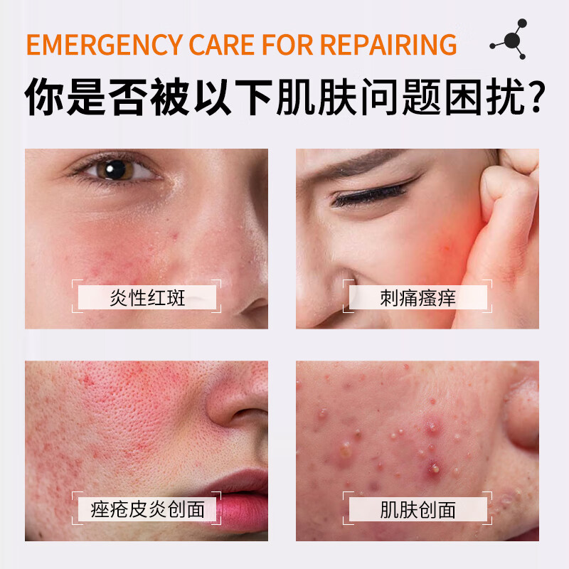 GEKX医用透明质酸钠修护凝胶皮肤优恒eokk凝胶aekz护理膜qpoo修复凝胶 1盒装【赠补水喷雾1支】院线同款