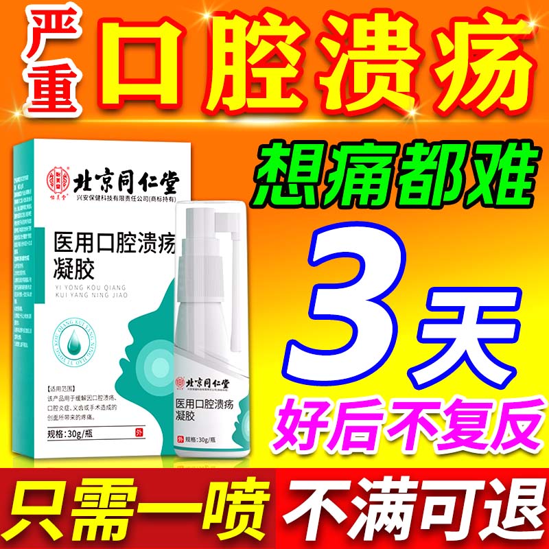 北京同仁堂口腔溃疡喷雾剂专用特效修复凝胶口舌生疮嘴巴上火起泡烂嘴的喷剂 单盒装【症状轻 30ml/盒】 口腔溃疡用什么药好的快儿童的药