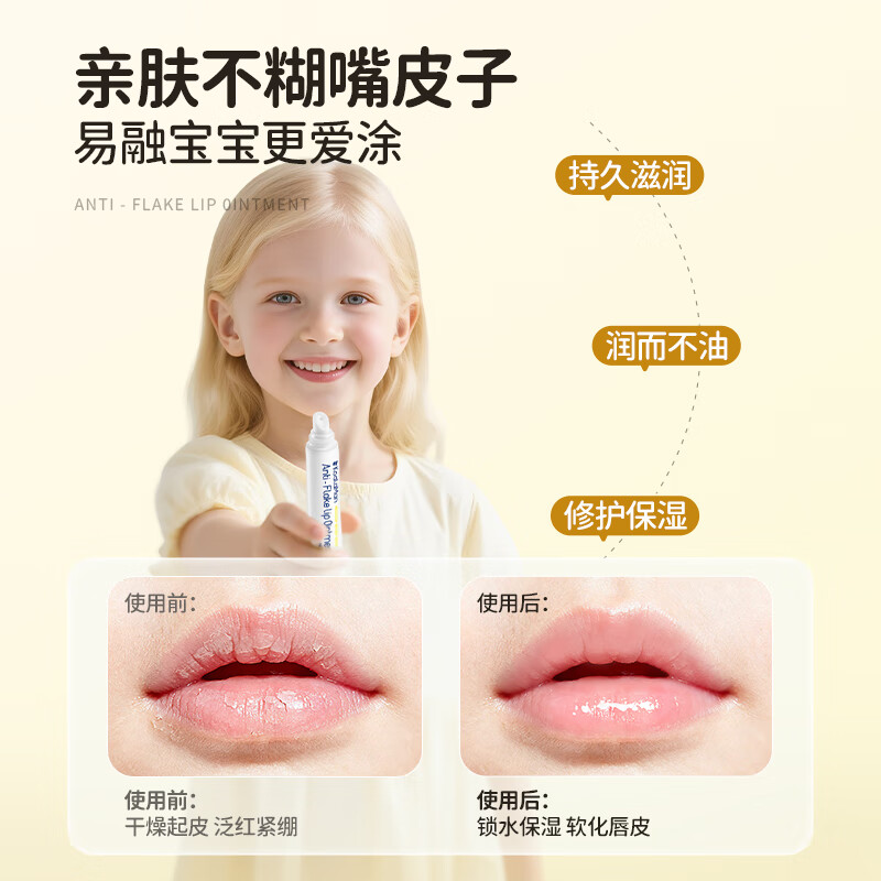 KoalaMan澳洲进口考拉侠儿童润唇膏宝宝婴幼儿润唇护唇秋冬保湿滋润防干裂 【植萃配方】儿童润唇膏15g