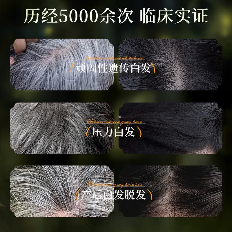 海文赫黑金罐洗发膏草本强韧护发白发转自然黑发根养发自然黑正品 2瓶装【优惠装】第二瓶半价 【官方直售 京质保障】