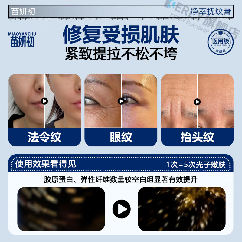 KERLY苗妍初净萃抚纹膏【官方旗舰】紧致抗皱淡化法令纹肥胖纹川字纹 【巩固装】买三赠二 5支装 官方直售