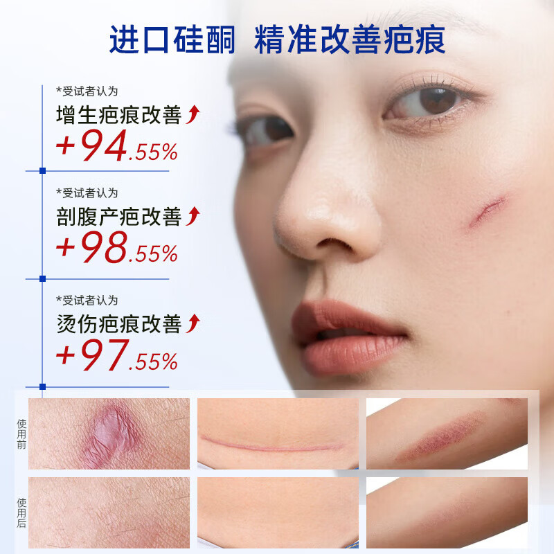 VEVT疤痕贴VVT硅酮贴EVT小蓝板剖腹产疤痕贴硅酮改善疤痕 一盒装（新生疤痕）