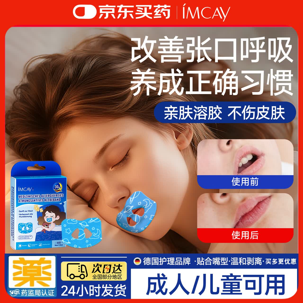 IMCAY医用口呼吸矫正贴闭口贴嘴巴呼吸矫正贴睡觉防张嘴打鼾腺样体肥大