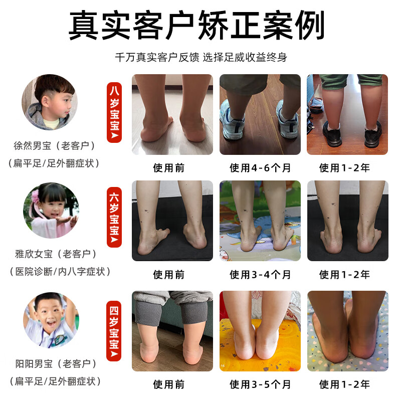 洛崽崽儿童扁平足足弓支撑专用矫正鞋内外八字纠正XO型腿足内外翻机能鞋 (黑白色)针对/足外翻/扁平足 30 码 内长19cm