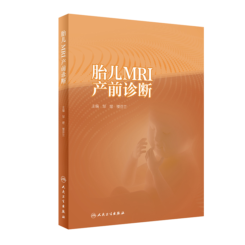 胎儿MRI产前诊断