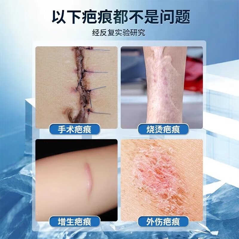 疤克祛疤膏儿童专用手术缝针疤痕修复除疤医用硅酮疤痕凝胶剖腹产 2盒[疤痕凝胶效果装]