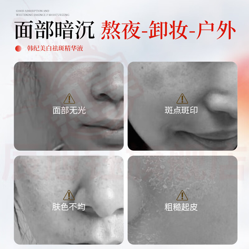 辰旭钰佐肤妮美白祛斑精华液喷雾补水保湿美容玻尿酸烟酰胺377美白精华 1瓶【抗氧提亮 锁水保湿 】 官方直售