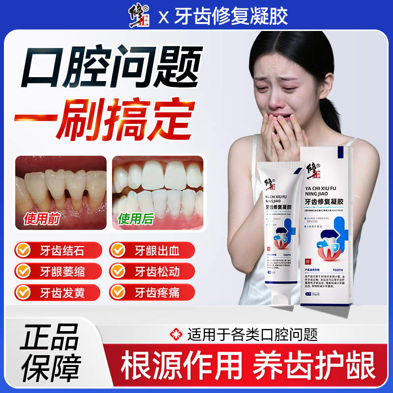 牙齿修复凝胶脱敏剂牙周炎牙龈萎缩修复抑制牙龈出血护龈专用三盒装