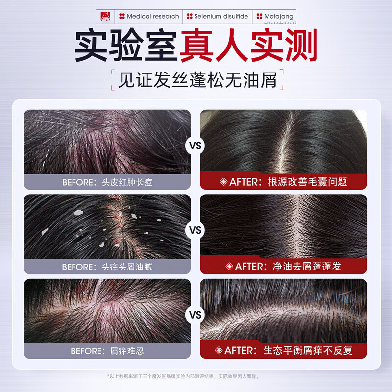 三个魔发匠二硫化硒洗发水500ml 控油去屑洗发液强效清洁蓬松清痘舒痒洗发露 一瓶 体验装
