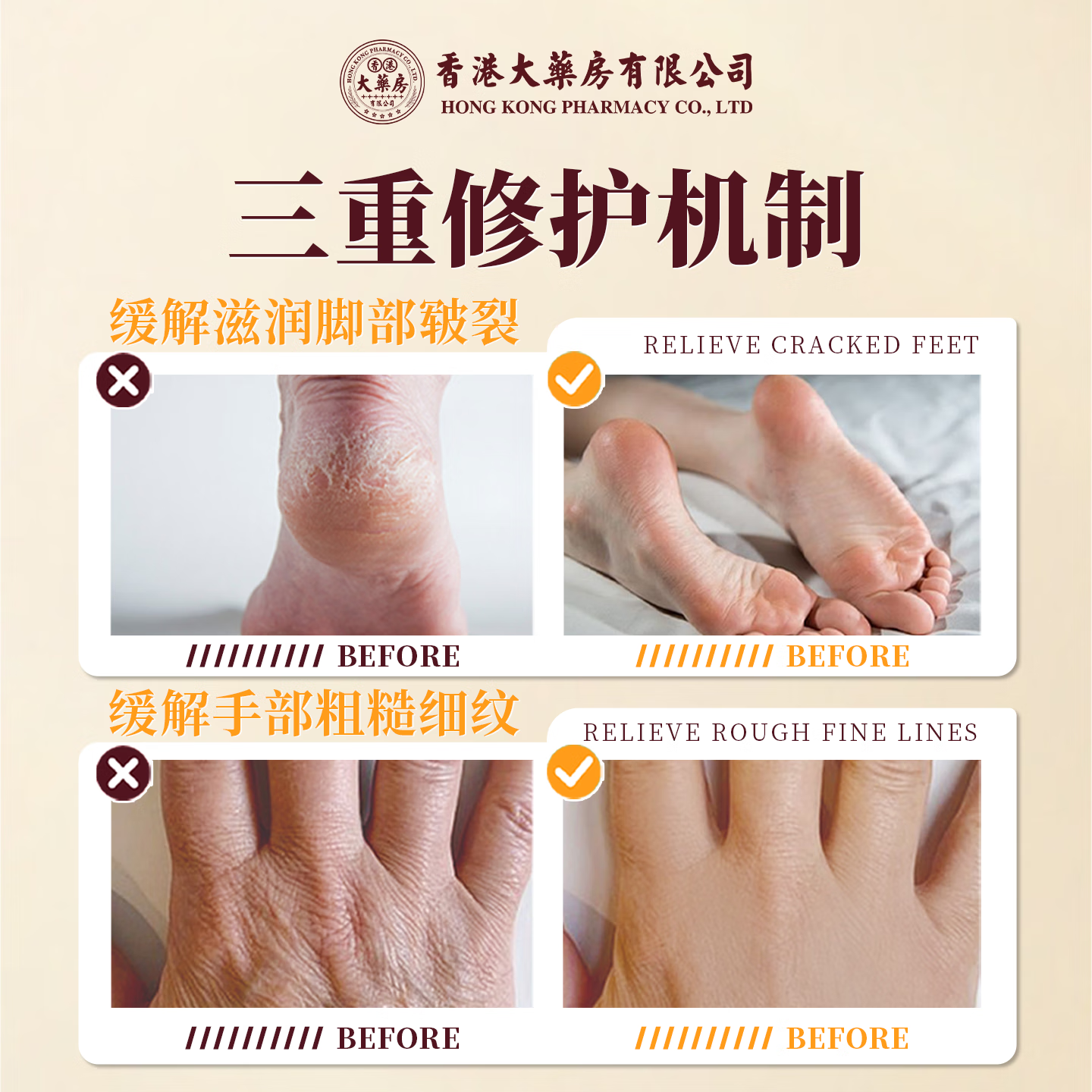 香港大药房马油防裂膏手足裂干裂护手霜脚裂脚后跟开裂手裂口严重足跟皲裂膏 1瓶【皮肤干裂】买2送1