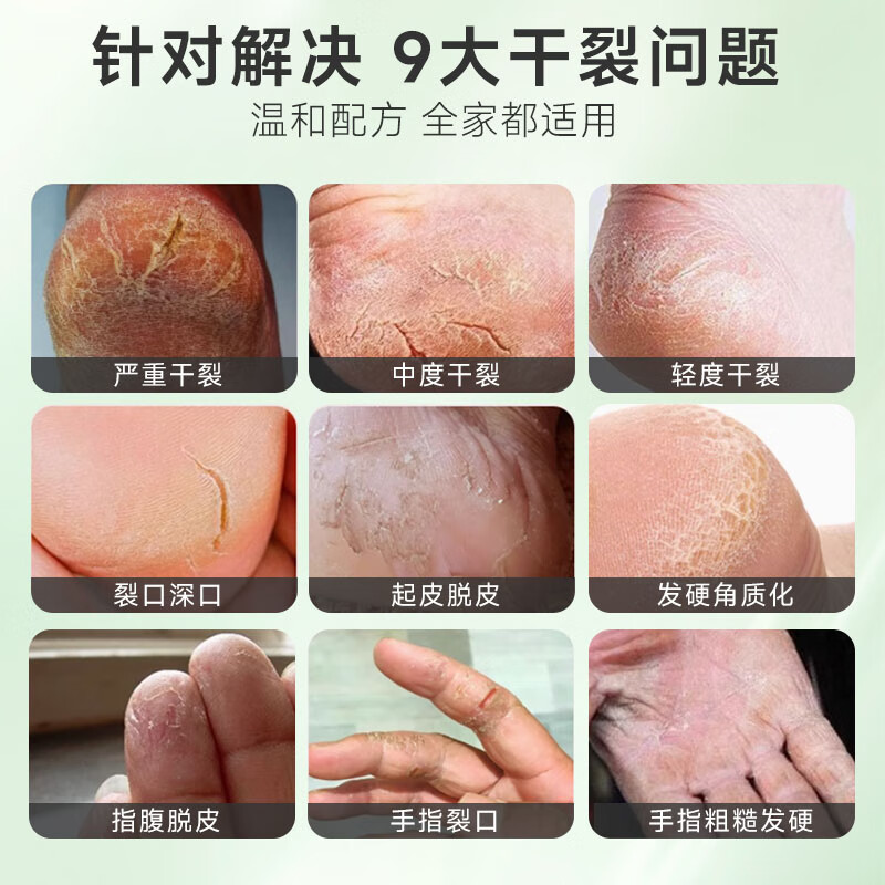 INGRAM'S南非小绿膏脚后跟干裂手部足部修护霜滋润保湿补水皴裂膏官方正品 150ml