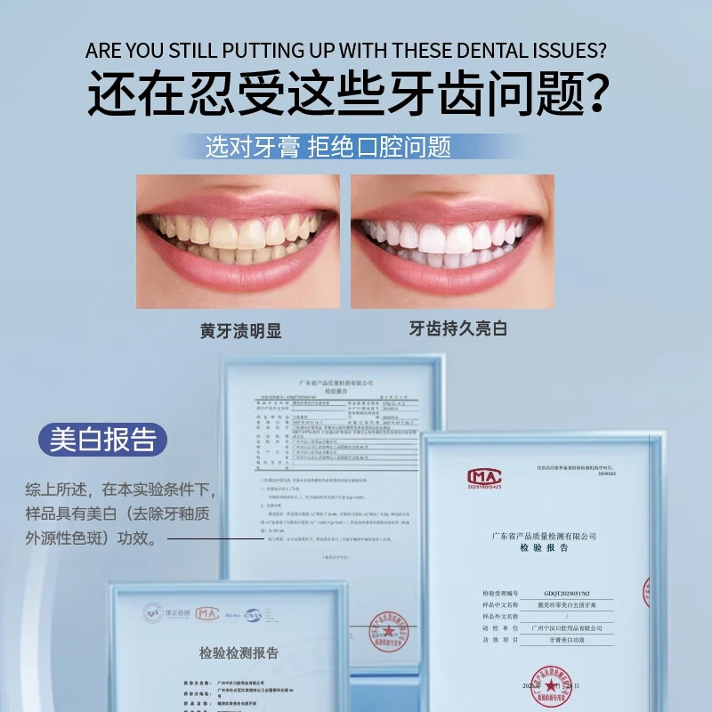 靓美玖零【院线同款】美白牙膏去黄去渍美白改善牙菌斑防蛀含氟牙膏成人 美白120g+去火护龈120g+儿童防蛀66g+儿童牙刷*2支