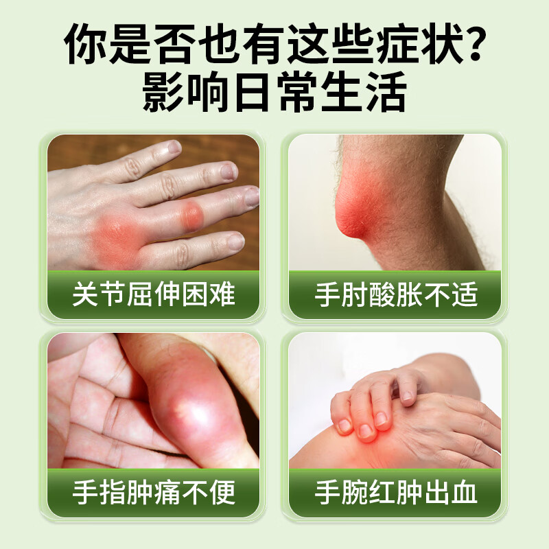 宝元堂腱鞘炎医用疼痛冷敷凝胶手腕手指囊肿痛网球肘腱鞘炎专用膏药喷剂 1个*2盒 【基础装】酸麻肿胀缓解 腱鞘炎喷剂大拇手指囊肿腱鞘炎型冷敷凝胶正品