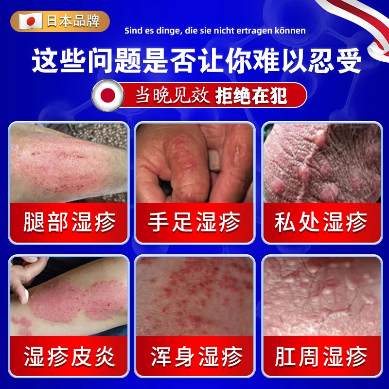 北京协和医学院湿疹药膏十大牌子皮肤瘙痒皮炎湿疹真菌感染止痒苗药日本原装进口 1盒喷+1盒抹【强效组合】柏可芬 诺瑞达湿疹冬季皮肤瘙痒止痒
