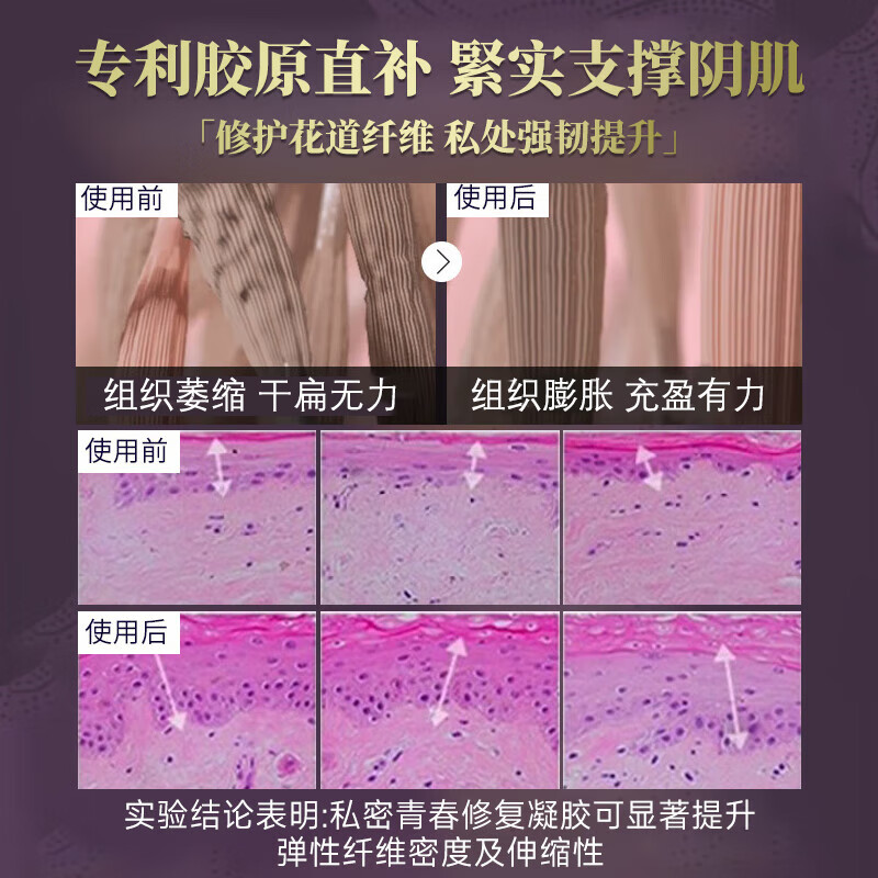 IRANY澳洲进口长肉芽私密紧致水润凝胶妇科紧致私处紧缩产后修护保养 【周期装-90%客户选择】 21ml*3盒 女性私密凝胶保养水润紧致干涩可同房医用
