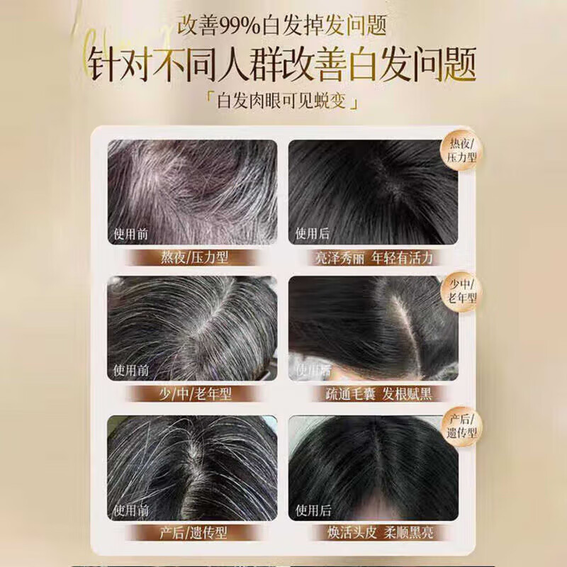 梦若羽（MRYU）诗碧曼养黑精华人参何首乌液自然草本植物养发防脱育发护发乌发 5瓶【买三送二  加强巩固】 官方授权