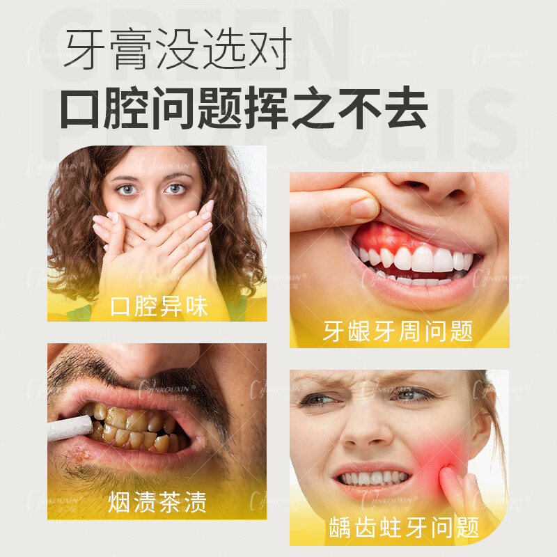 金口馨健齿护龈牙膏 减少牙周问题亮白防蛀口腔护理牙周可用蜂胶牙膏 3支装【减少牙龈问题】