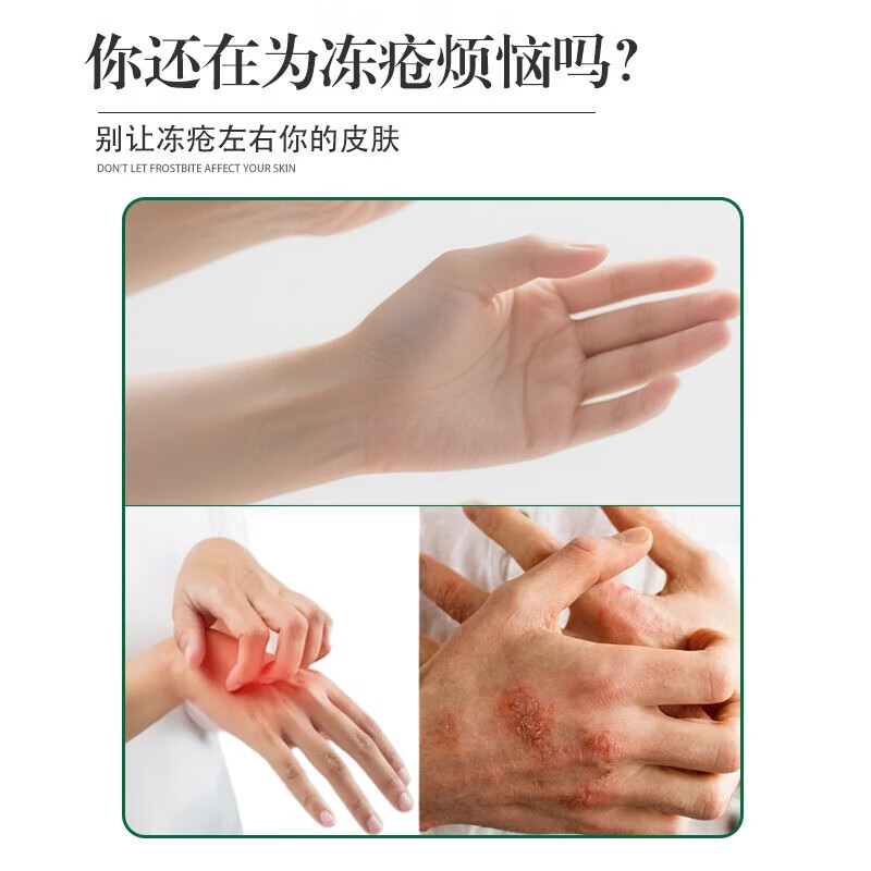 安兴堂冻疮膏防裂护手霜防脚后跟开裂脱皮保湿搭防冻去痒 10罐装