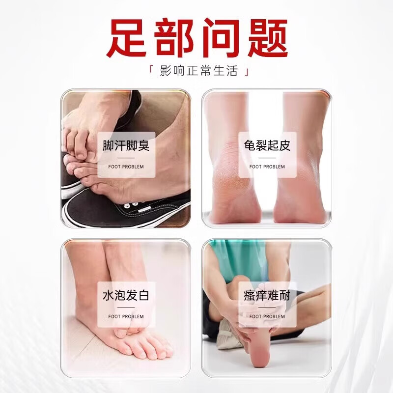 内廷上用同仁堂医用级壳聚糖喷雾剂脚气出汗烂脚丫脱皮真菌感染止痒手足癣 【1盒体验装】50ml/盒