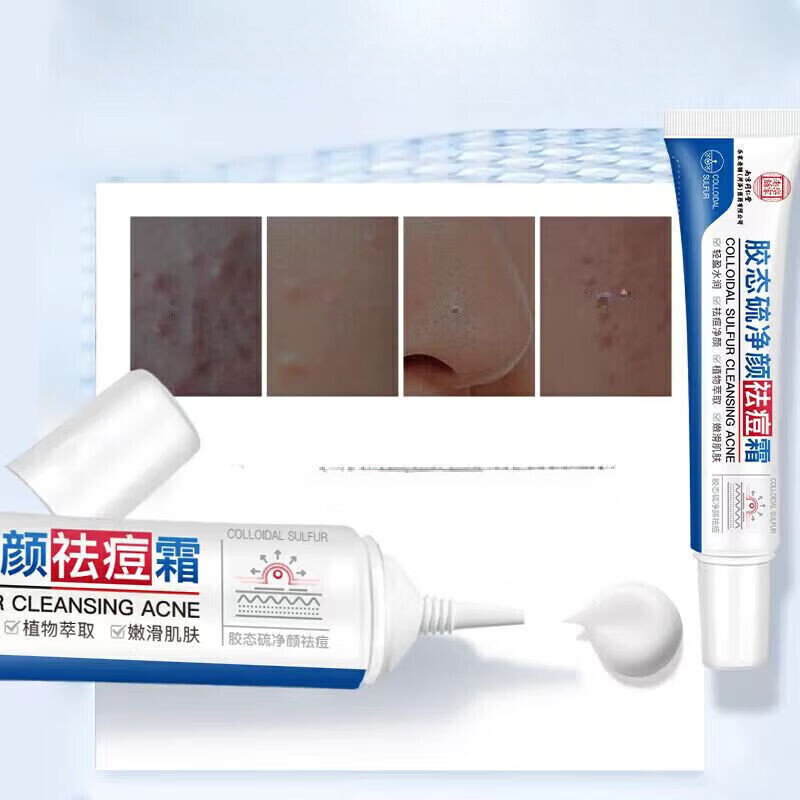 乐家老铺南京同仁堂胶态硫净颜祛痘霜学生成人可用祛痘膏药房同款保湿软膏 20g*10盒【团购套装】