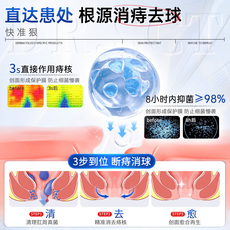 DR.SCT痔疮膏去肉球凝胶神器去内外混合痔肛门瘙痒便秘便血通用 升级款痔疮凝胶【5盒装】