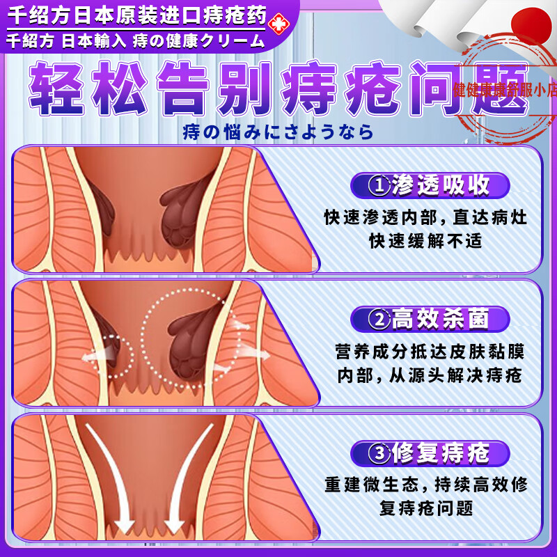 然舒平痔疮膏消肉球便血肛裂混合内外痔肛门瘙痒消痔疮凝胶正品 二支【见效装】 【正品直售 京质保障】