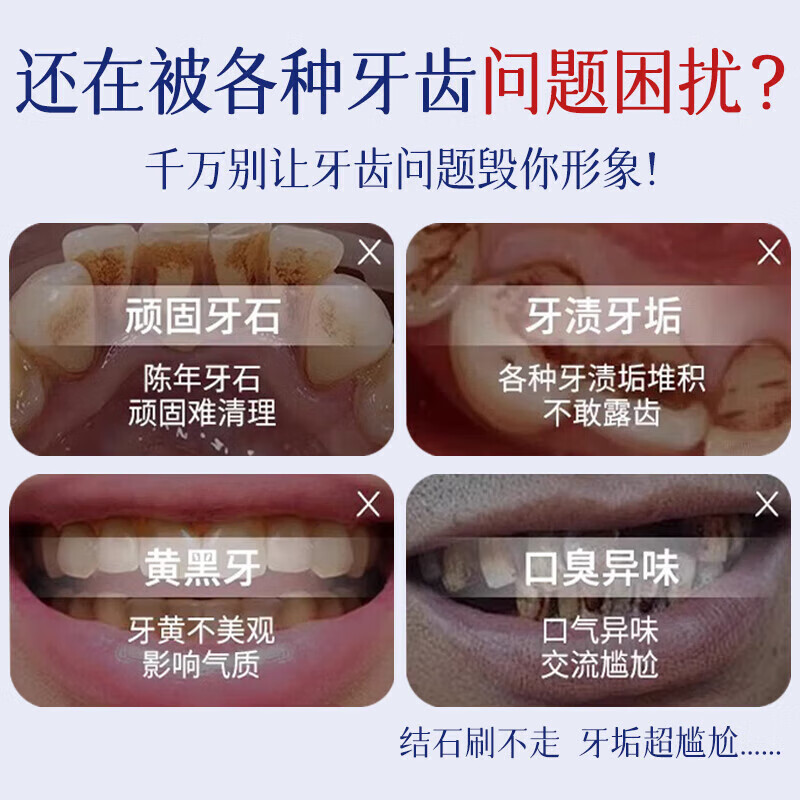 坂枝野寻漱口水便携牙结石口臭去黄牙石牙垢牙周膏炎牙渍速傚溶解清新口气 买二送一【周期装】3瓶