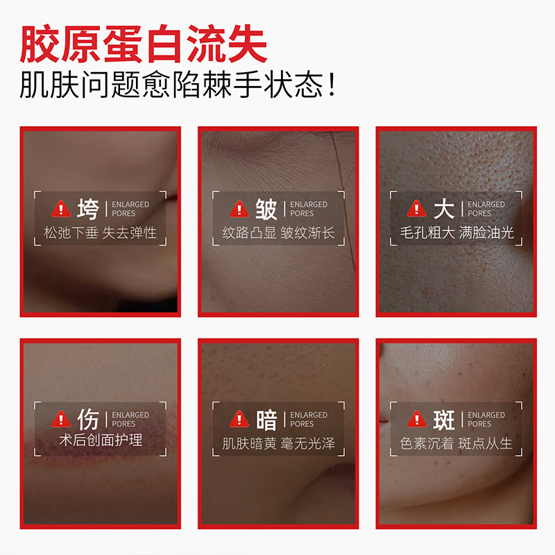 VEVT胶原膜vevt护理膜细腻毛孔淡化纹路vvt胶原蛋白护理膜修复敷料 三盒装【改善纹路/粗毛孔】98%顾客选择