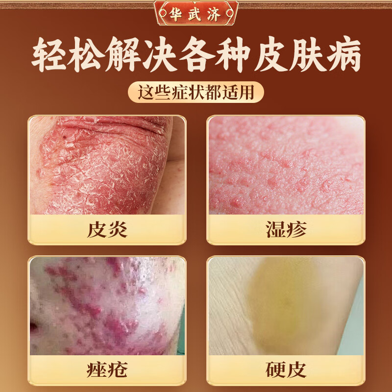 华武济顽固皮炎湿疹牛皮癣皲裂手癣鹅掌风脚癣皮肤瘙痒外用中药凝胶无激素 一盒（适用轻症 缓解改善）