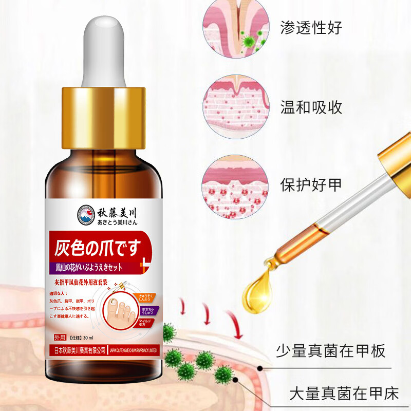 凤仙花官方旗舰店凤仙花抑菌液灰指甲凝胶套装温和吸收男女通用 30ml*3（多买优惠）