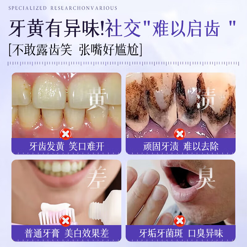 Croent葡萄籽牙膏清新口气减轻牙渍牙垢牙黄口腔牙龈护理牙齿洁白 葡萄籽牙膏3支