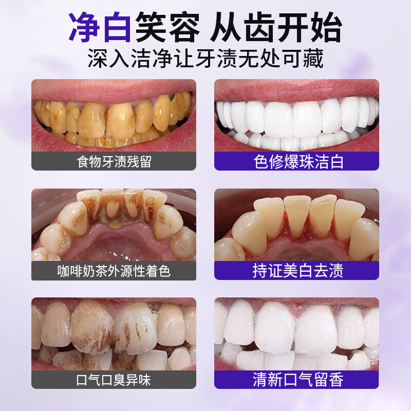 芮俏色修爆珠紫管牙膏美白护龈日常护理 [热卖]美白牙膏100g*1盒