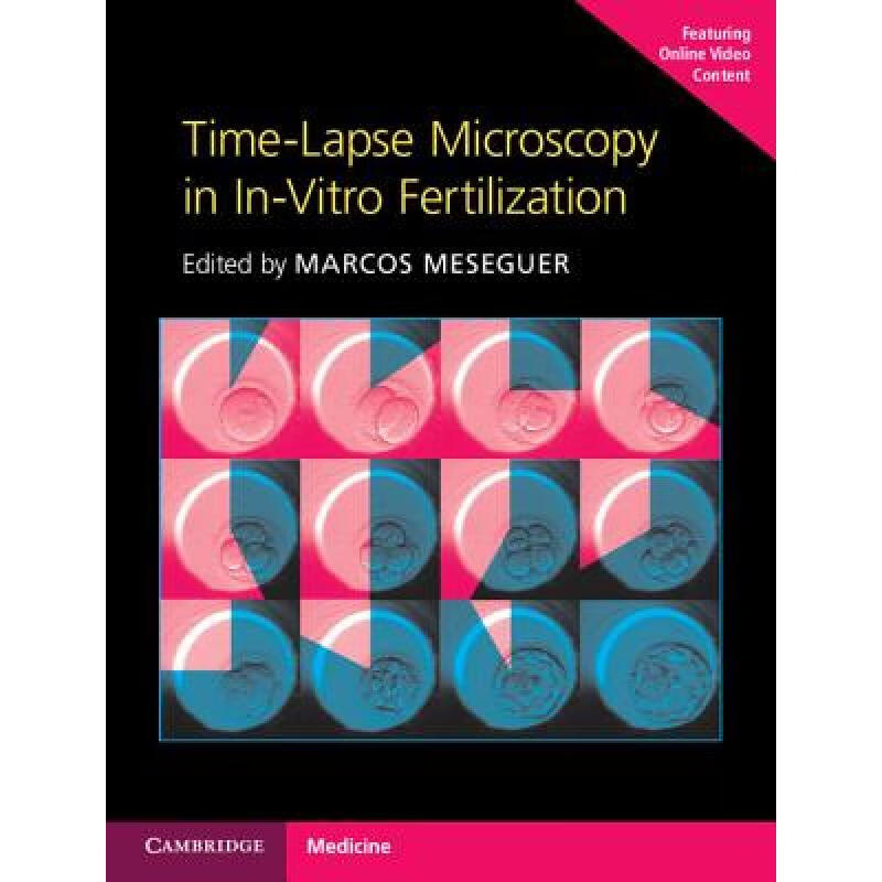 预订 Time-Lapse Microscopy in In-Vitro Fertilization Hardback with Online Resource