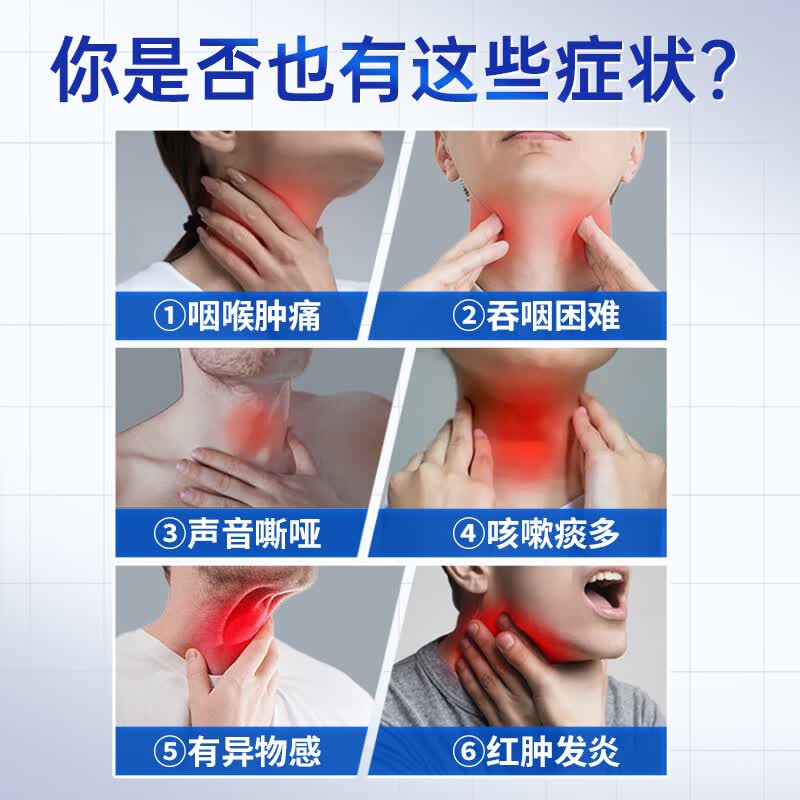 安泰宁咽扁穴位磁疗贴辅助治疗急慢性咽喉炎扁桃体发炎咽喉肿痛干咳不适 4贴*3盒 装【长效巩固调理】