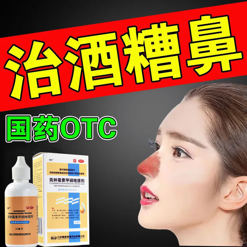 酒糟鼻用药】除螨虫痤疮粉刺草莓鼻红鼻子酒渣鼻红鼻子红肿疙瘩毛囊炎